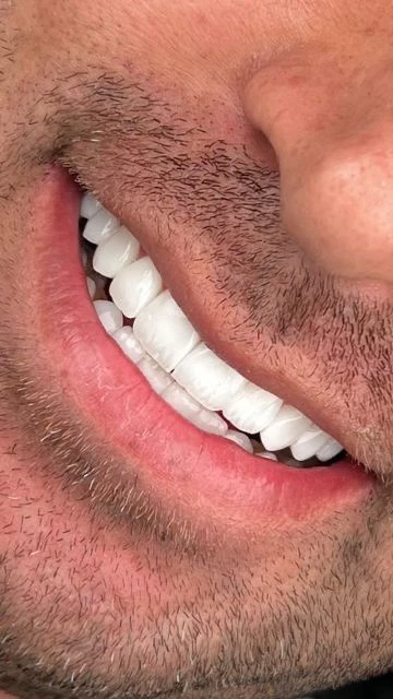 Close-up of a man's bright, white smile