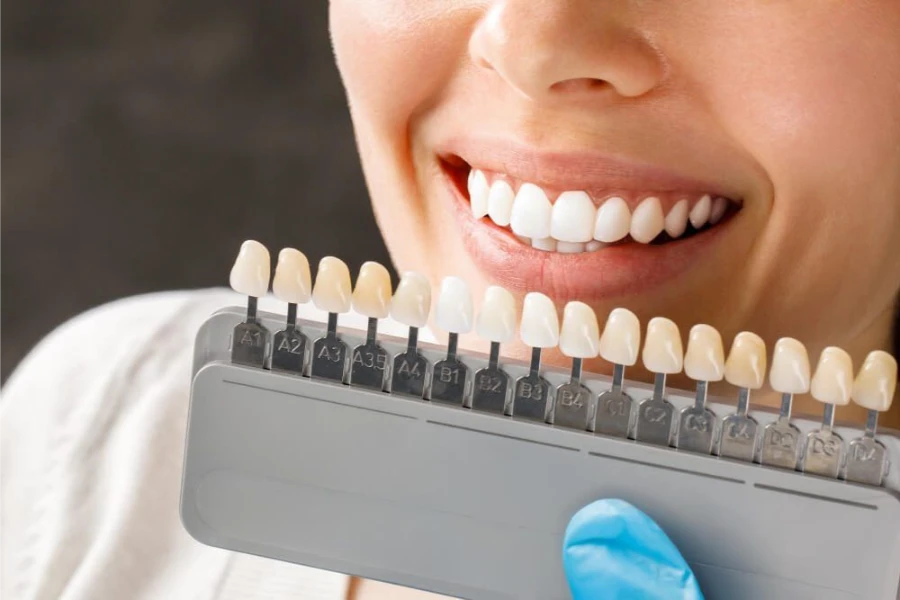 Smile being matched against a tooth shade guide