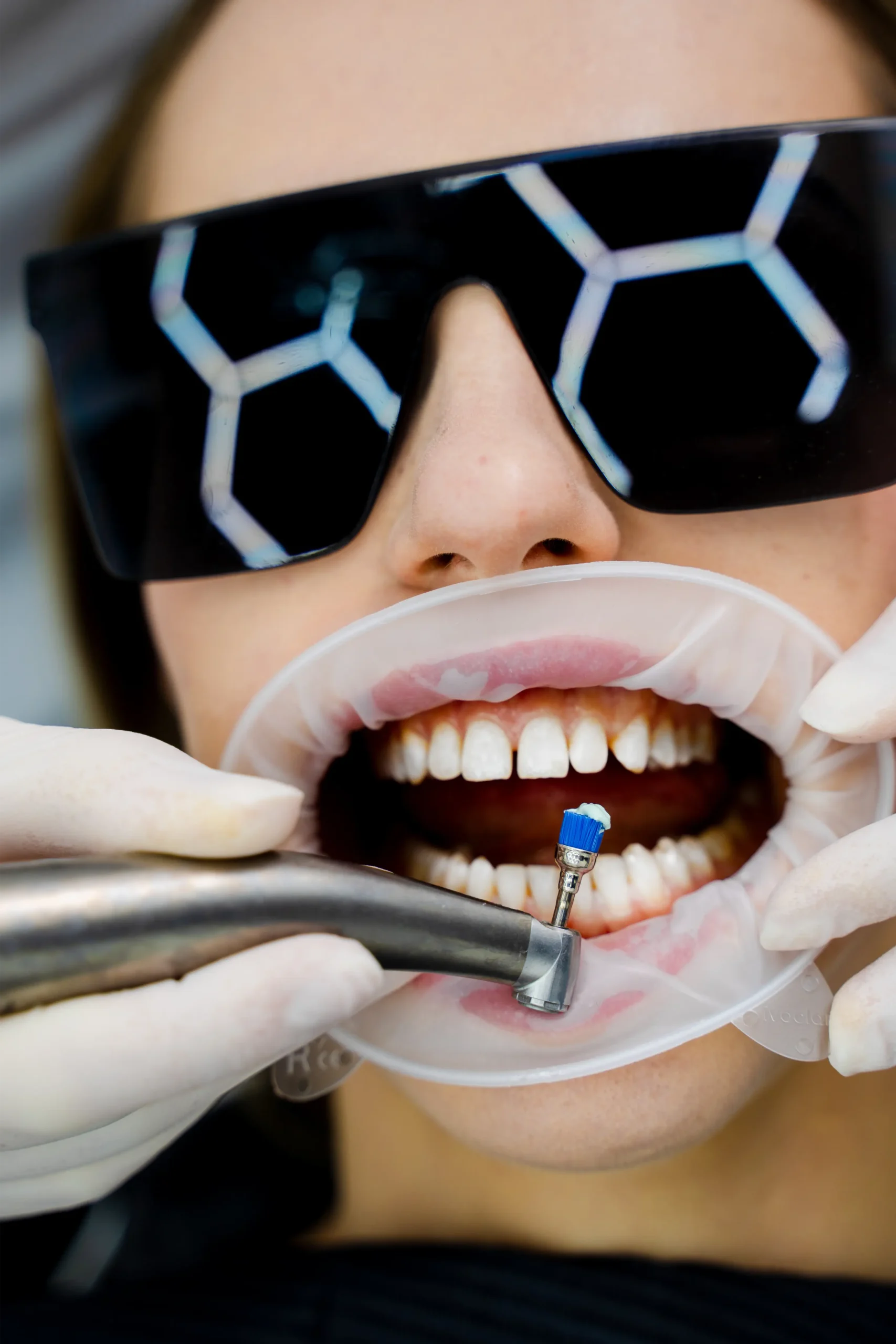 Close-up of a woman at the dentist