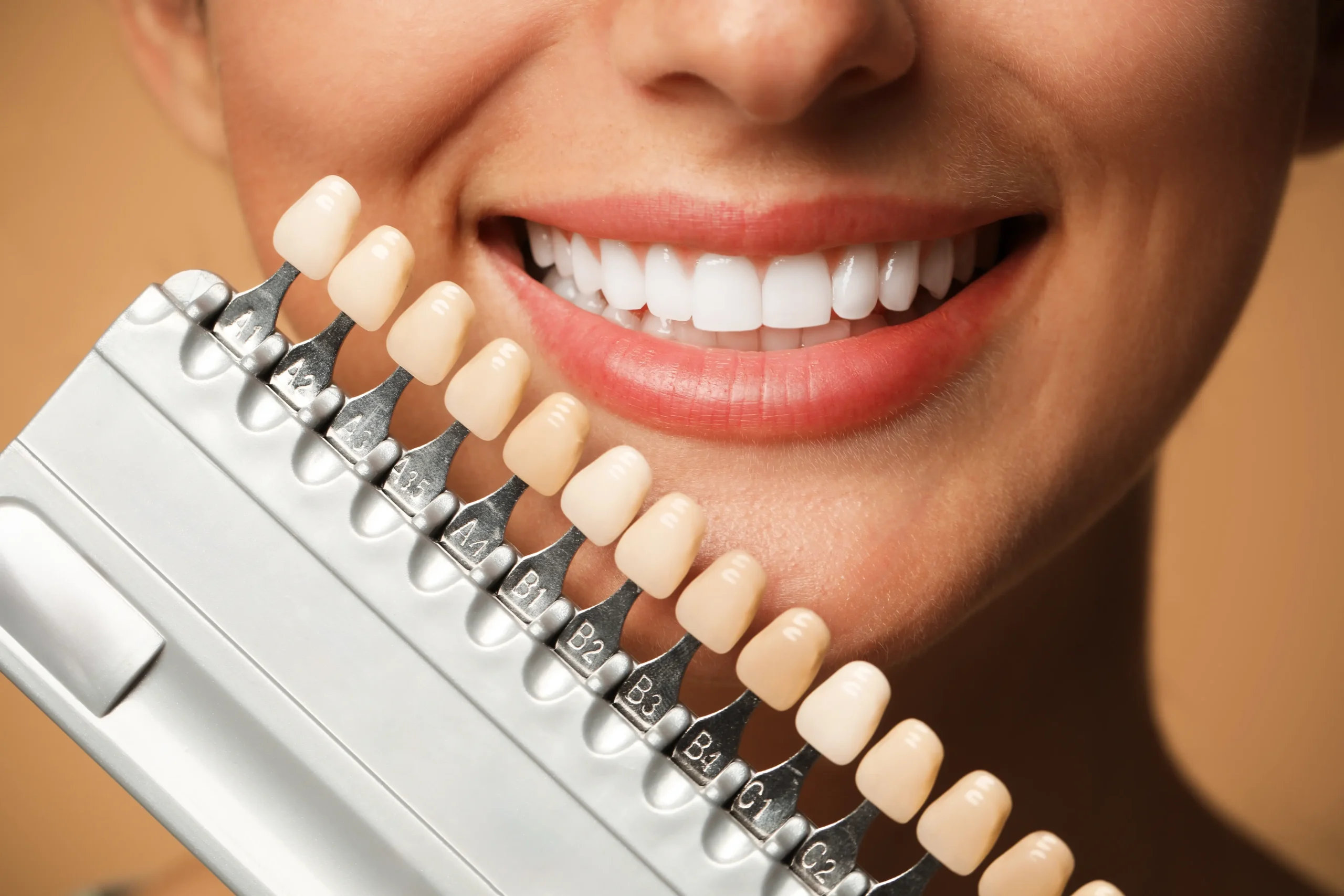 Smile being matched against a tooth shade guide for whitening