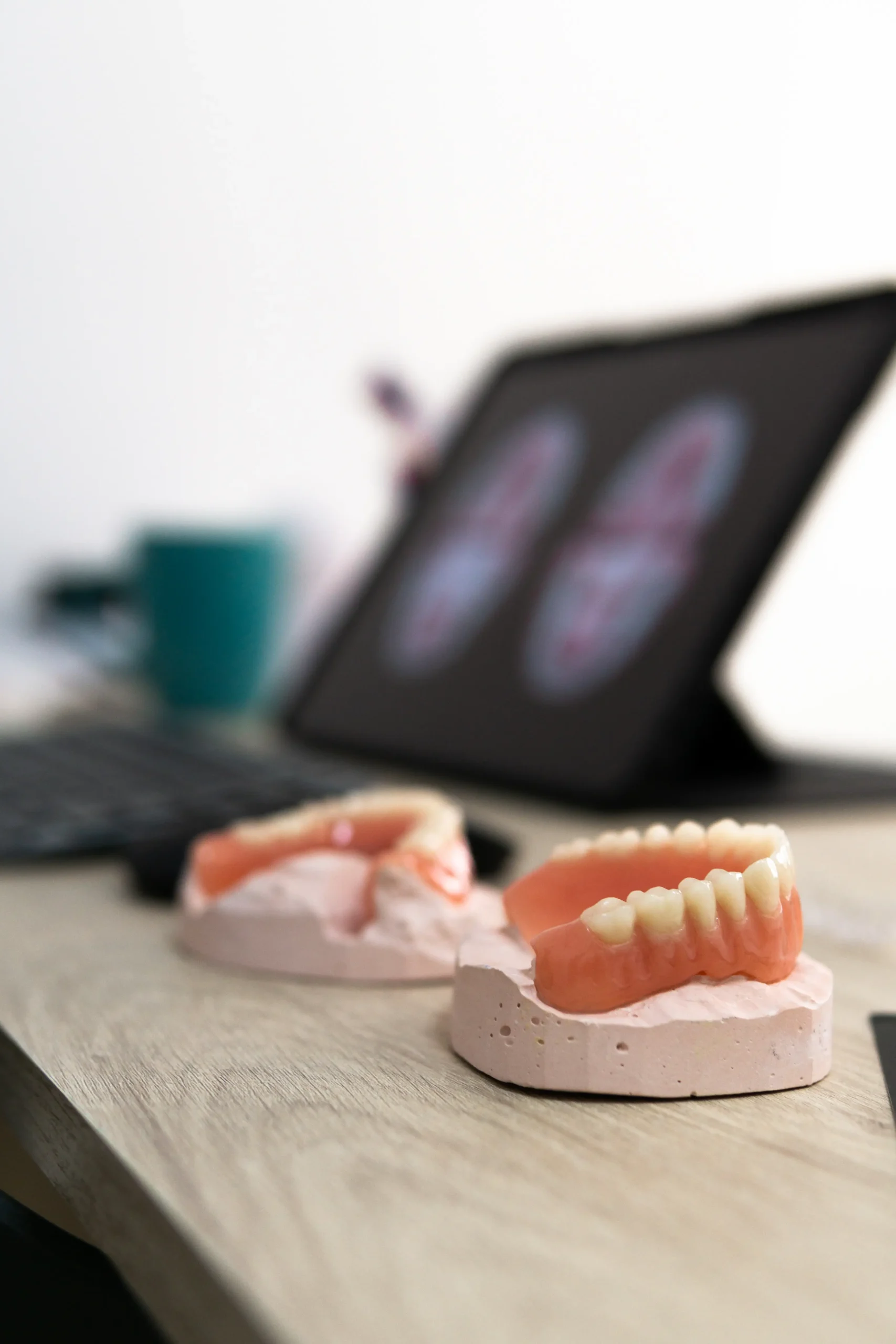 Prosthetic sets of teeth